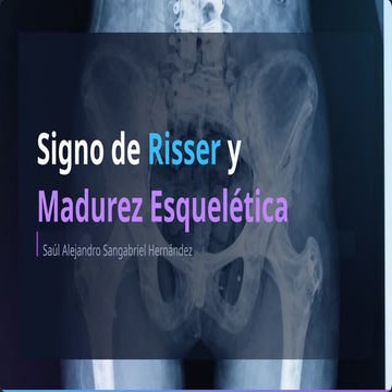 Evaluación del Signo de Risser y Madurez Esquelética en Escoliosis | PPTX