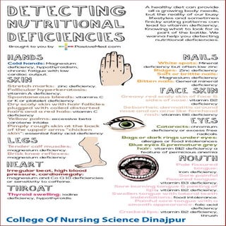 Sign of nutritional deficiency