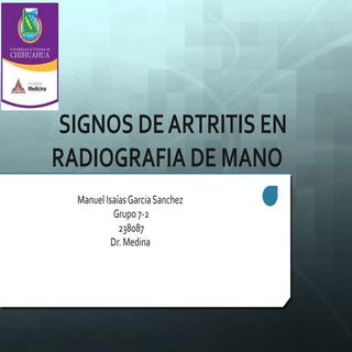 Signos radiologicos de artritis