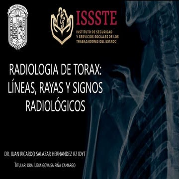 ANATOMÍA RADIOLÓGICA Y PROYECCIONES DE RX DE TÓRAX.pptx