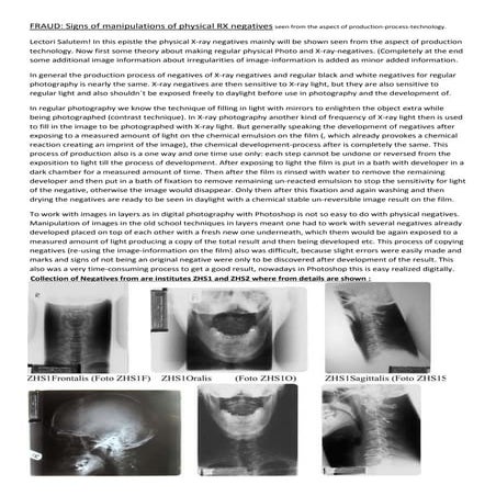 Rtfi weld defects[1] | PDF