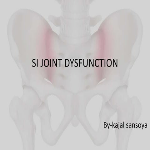 SI JOINT DYSFUNCTION.pptx