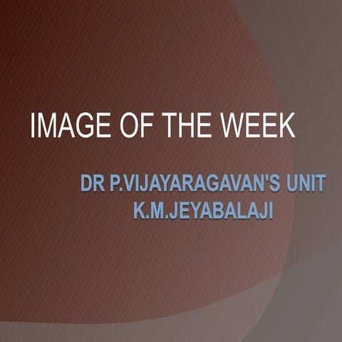 CXR: Silico-Tuberculosis