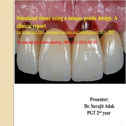 Innovative Pontic Design for Simulated Tissue in Implant-Supported ...