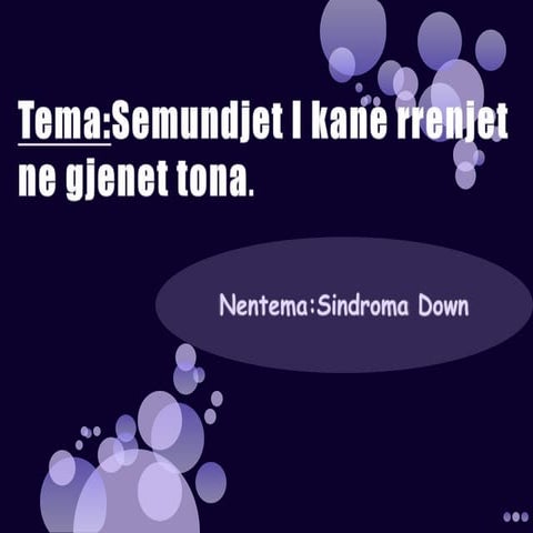 Sindroma down
