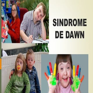 Sindrome de Down (folleto)