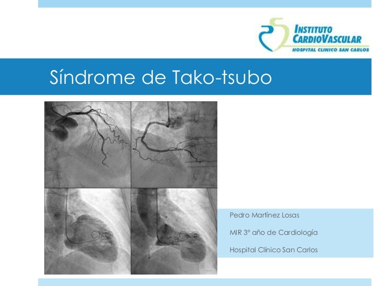 Sindrome Di Tako Tsubo Si Guarisce
