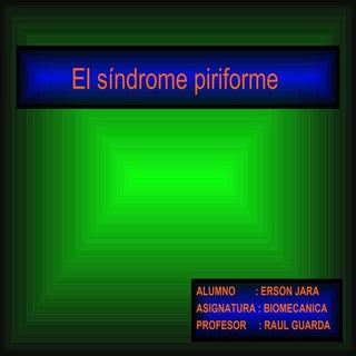 SINDROME DEL PIRIFORME