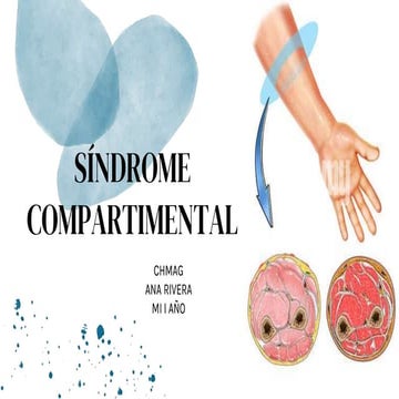 diapositivas de Sindrome compartimental.pptx