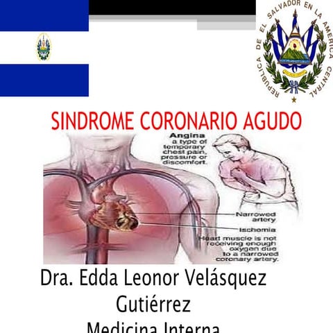 Sindrome coronario agudo 