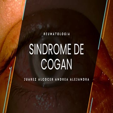 Comprehensive Overview of Cogan Syndrome: Pathophysiology, Diagnosis ...