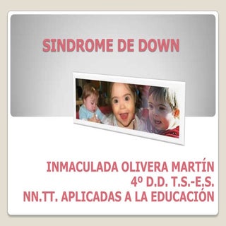 Sindrome de down