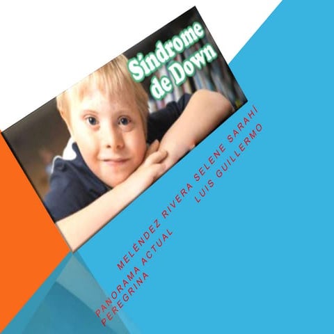 SINDROMEDE DOWN 