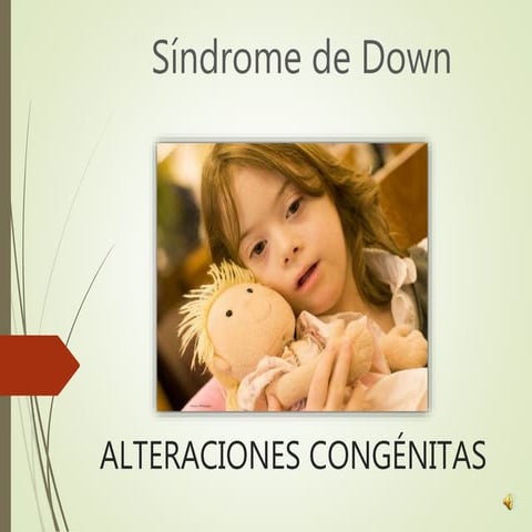 Sindrome de down