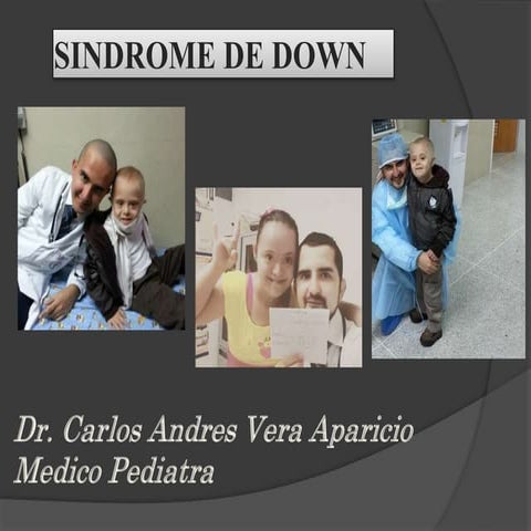 SINDROME DE DOWN.pptx