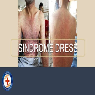 Sindrome de Dress.pptx