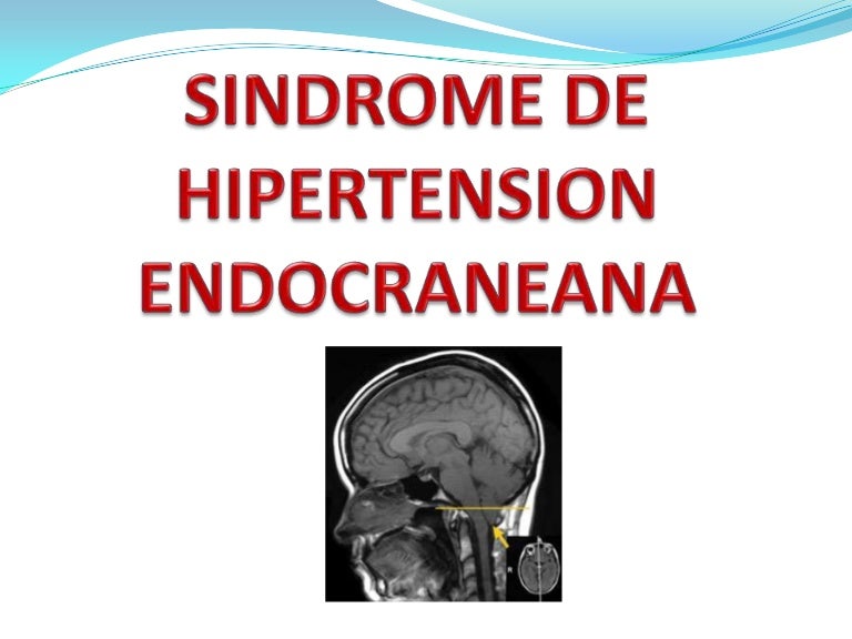 Puede doxy causar hipertensión intracraneal