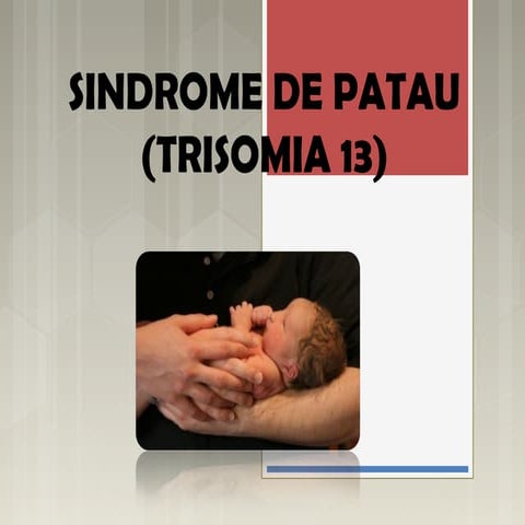 Sindrome de patau | PPT