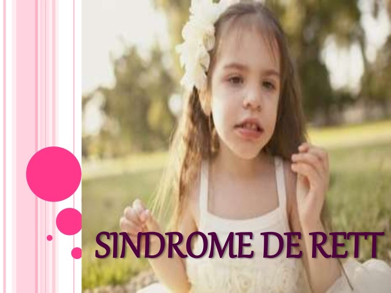 Sindrome de rett
