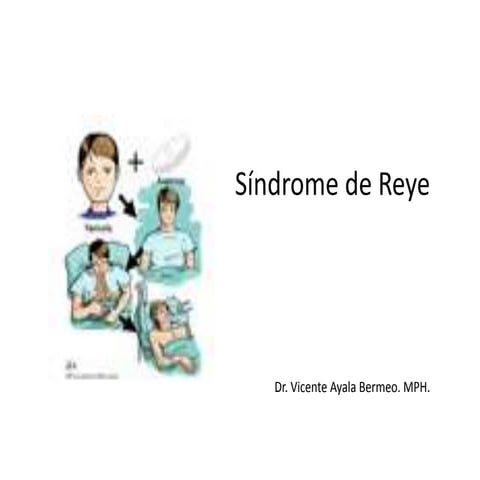 Sindrome de reye | PPTX