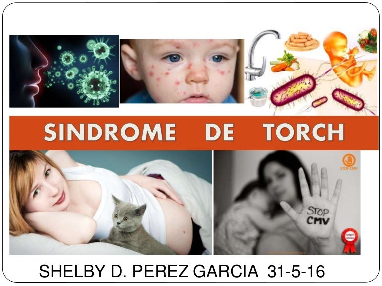 Sindrome de torch