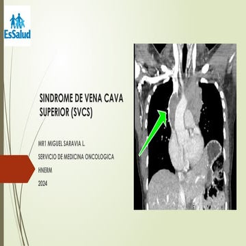 SINDROME DE VENA CAVA SUPERIOR (SVCS).pptx