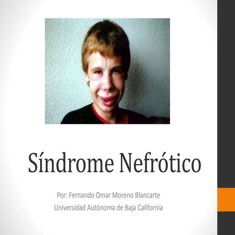 Sindrome nefrotico