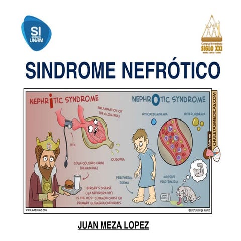 SÍNDROME NEFRÓTICO PEDIÁTRICO