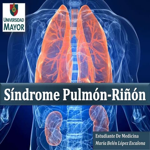 Síndrome Pulmón- Riñón | PPTX
