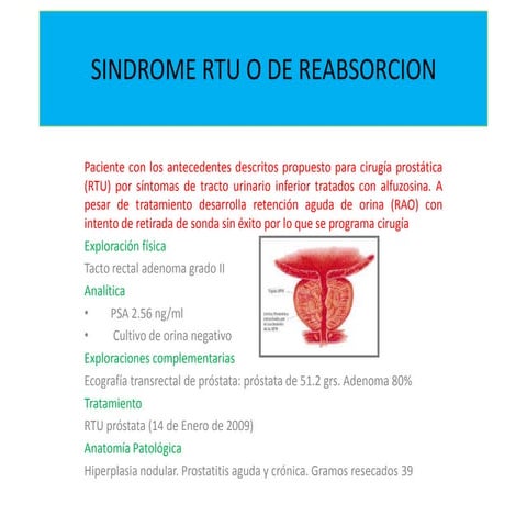 Sindrome rtu 2