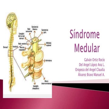 Sindromes medulares 9°d (comp)