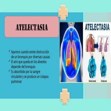 SINDROMES PULMONARES SEMIOLOGIA.(2).pptx