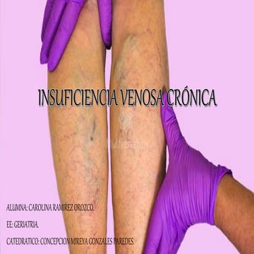 INSUFICIENCIA VENOSA CRONICA