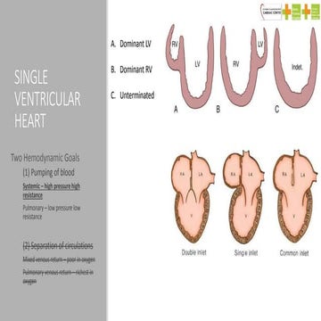 Single ventricle palliation | PPTX