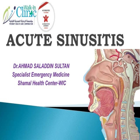 Sinusitis