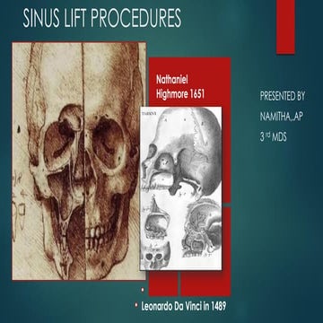 Sinus lift procedures.pptx