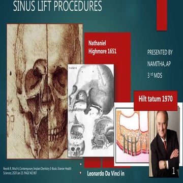 Sinus lift procedures. final copy of presentation pptx