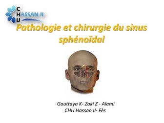 Pathologie et chirurgie du sinus sphénoïdal