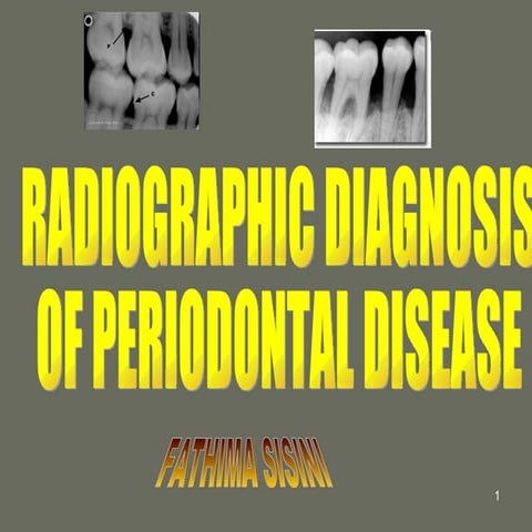 radiographic diagnosis of periodontal disease