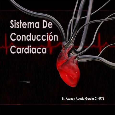Sistema de Conducción