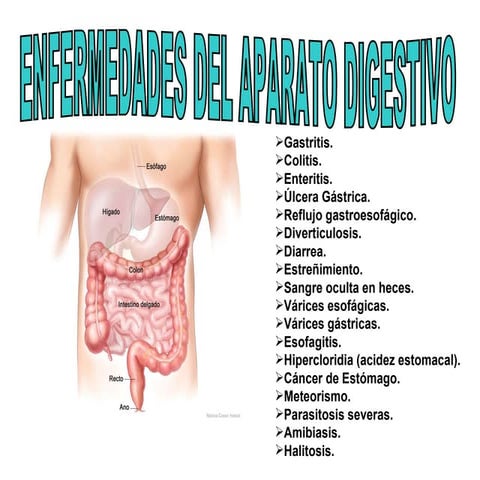 Sistema digestivo enfermedades