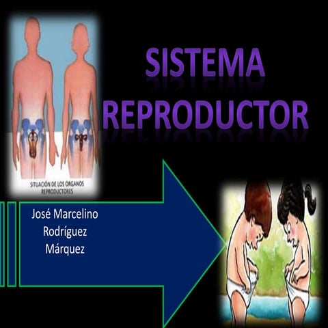 Sistema reproductor