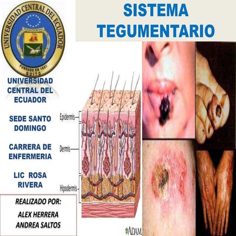 Sistema tegumentario licen rocita   copia