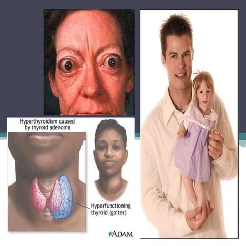 Sistem endokrin kskbkk