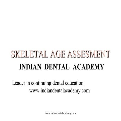 Skeletal age assesment /certified fixed orthodontic courses by Indian dental ...