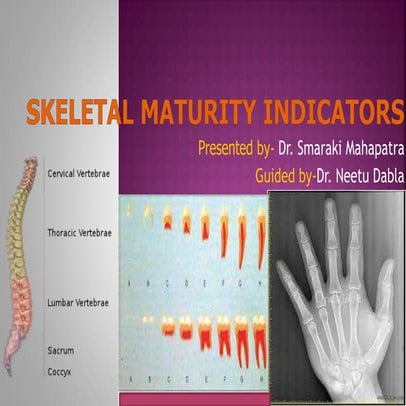 Skeletal maturity indicators.pptx modified