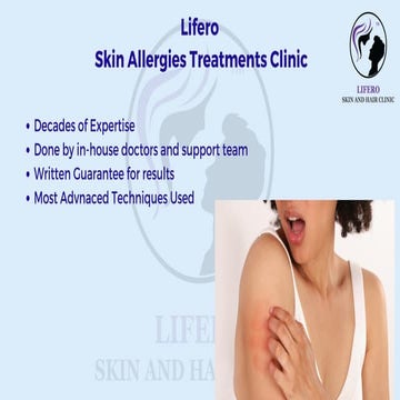 Skin Allergies Treatment .pdf