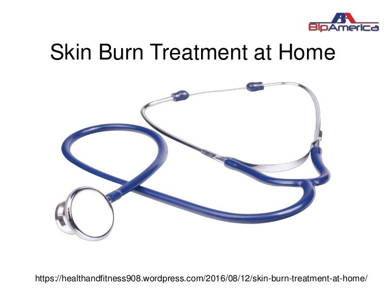 Skin burn treatment at home