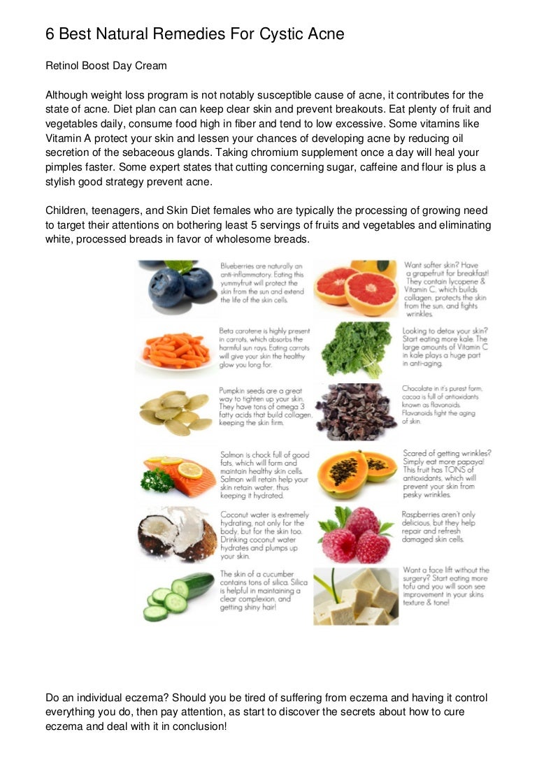 herbal remedies for cystic acne