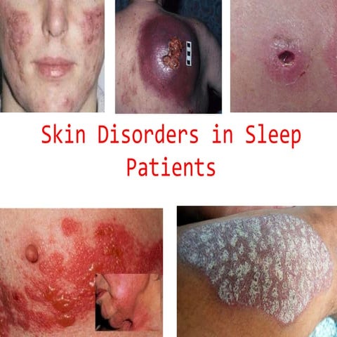 Skin disorders pp